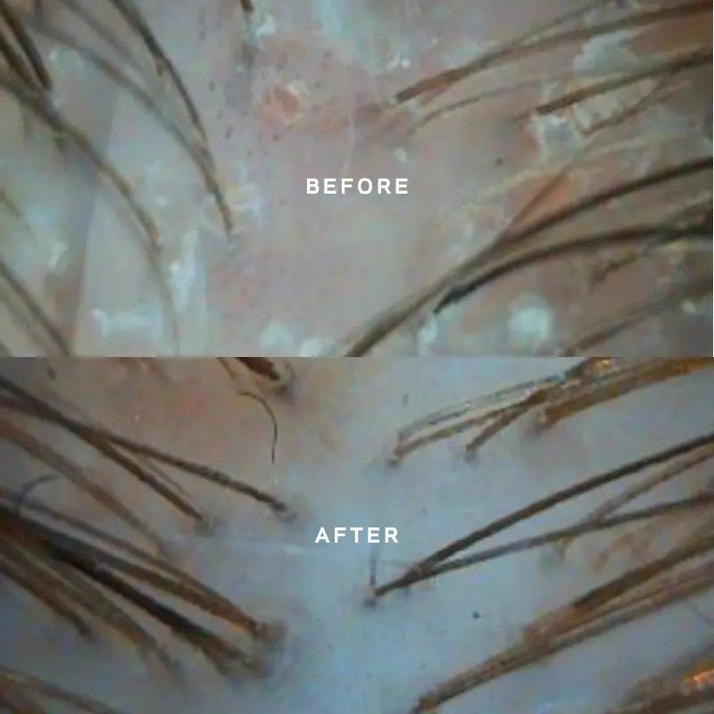 Miriam Quevedo Black Baccara Hair Mult Scalp Conc + Pre Treat